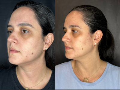 Cópia de Cópia de Cópia de Cópia de Cópia de Brown Minimalist Skincare Before After Collage Instagram Post (1)